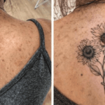 Can you get a tattoo over scars