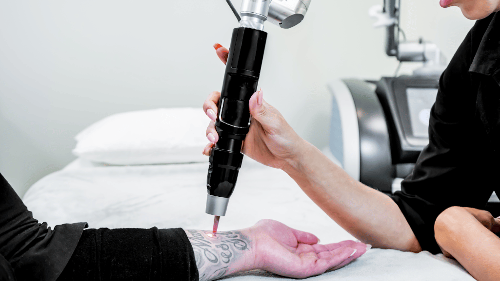 how many sessions to remove a tattoo