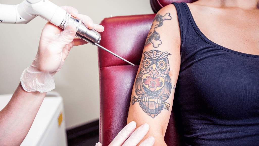 how many sessions to remove a tattoo