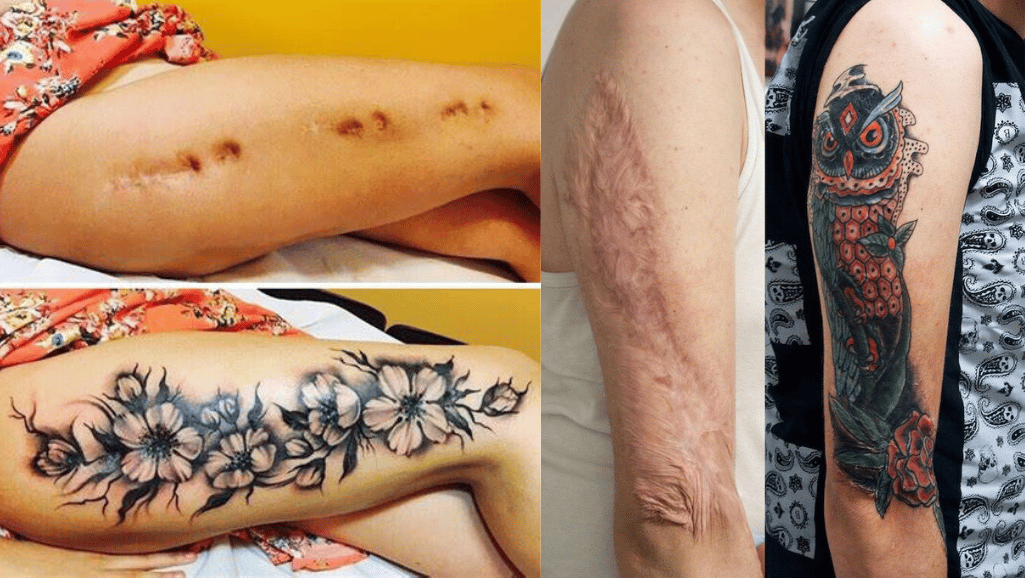 can i tattoo over a scar best one